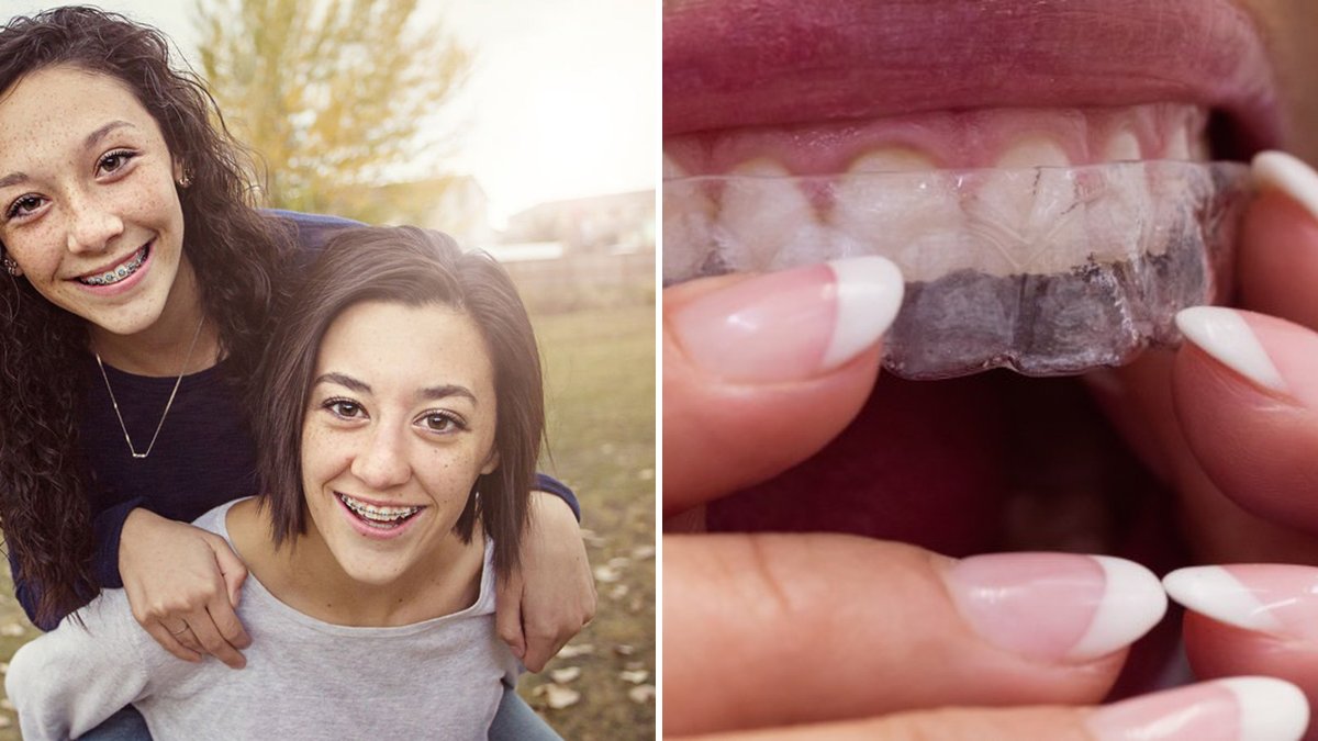 Left: two smiling teens wearing metal braces. Right: a patient fitting a clear Invisalign aligner over her teeth