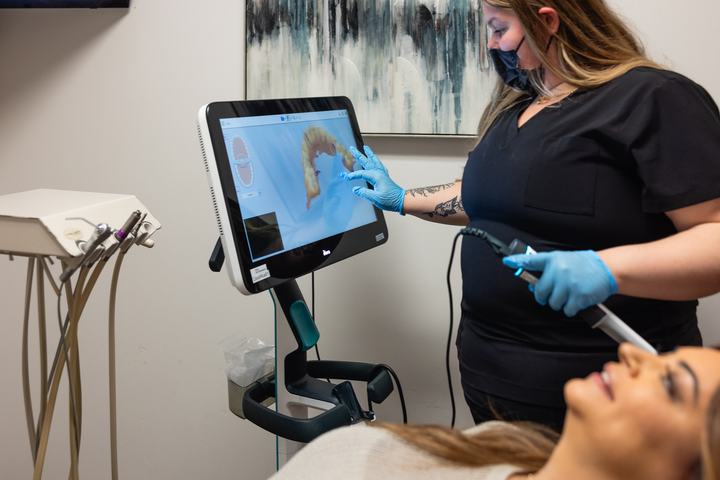 Digital iTero scan of a patient's teeth
